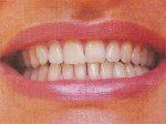 Belles dents - 